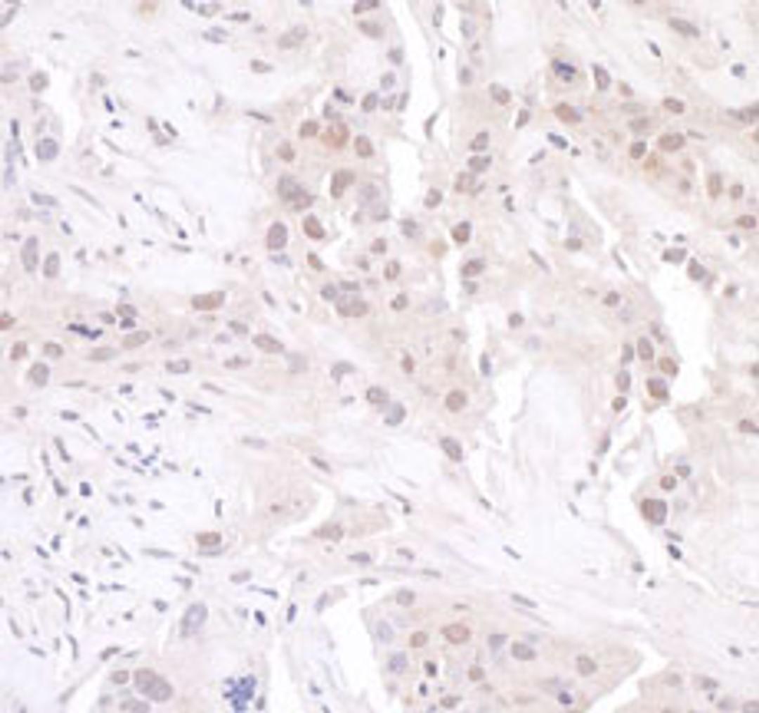 Detection of human GAPDH by immunohistochemistry.