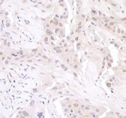 Detection of human GAPDH by immunohistochemistry.