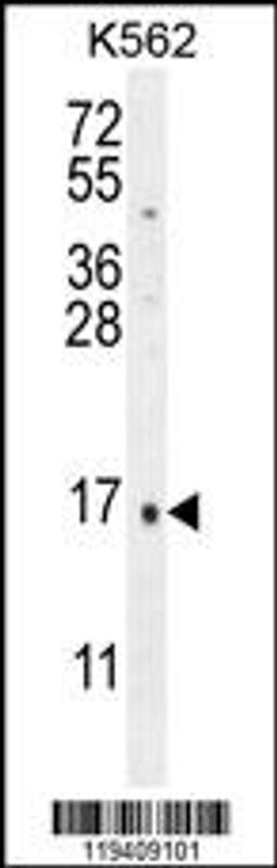 Western blot analysis in K562 cell line lysates (35ug/lane).