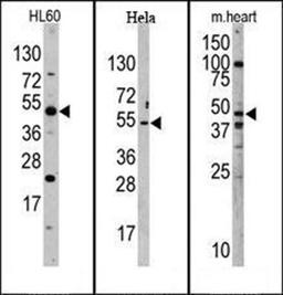 Western blot analysis of mouse heart, Hela, and HL60 cell line lysates using JMJD6 (PTDSR) antibody (N-term)