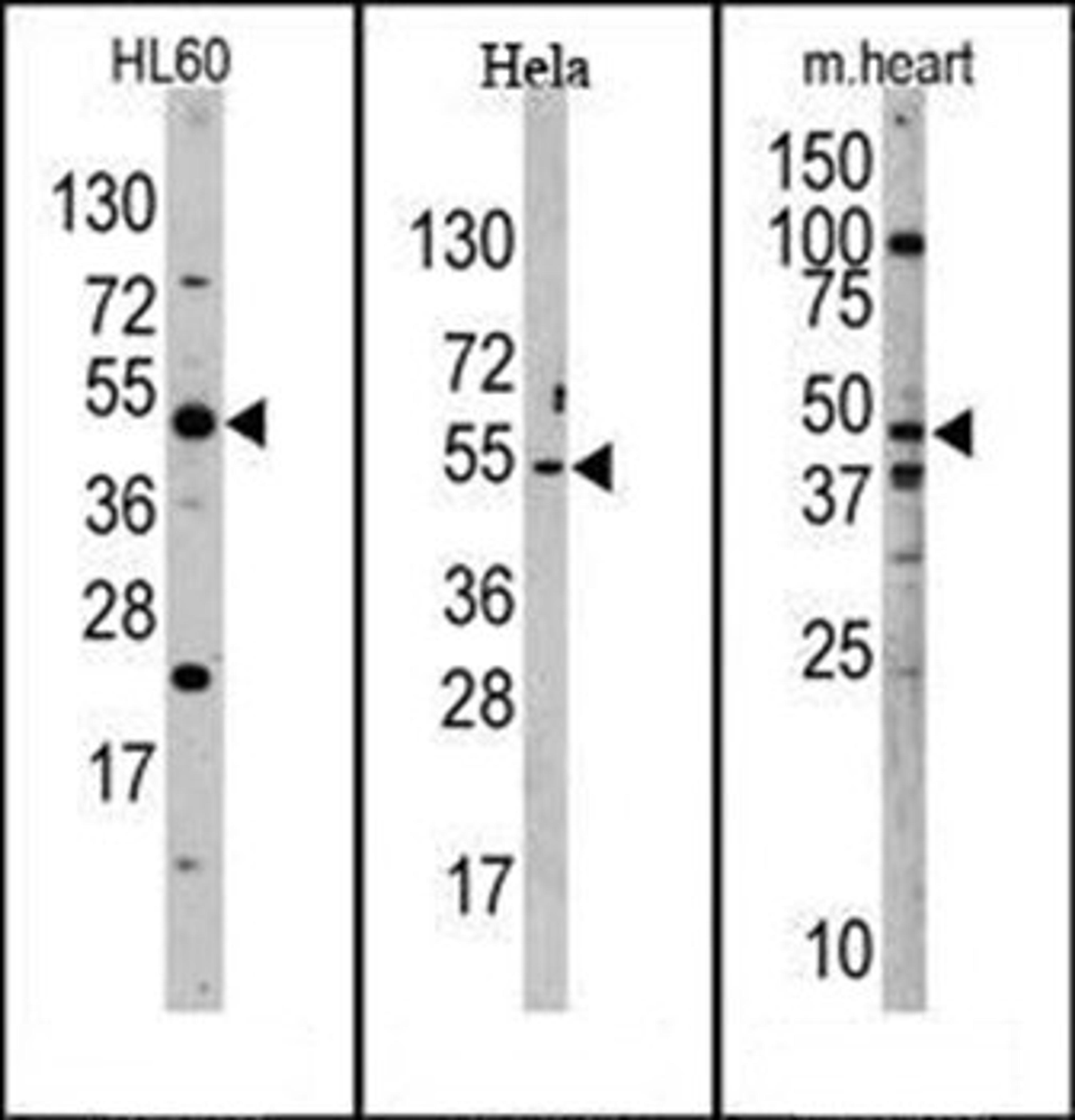 Western blot analysis of mouse heart, Hela, and HL60 cell line lysates using JMJD6 (PTDSR) antibody (N-term)