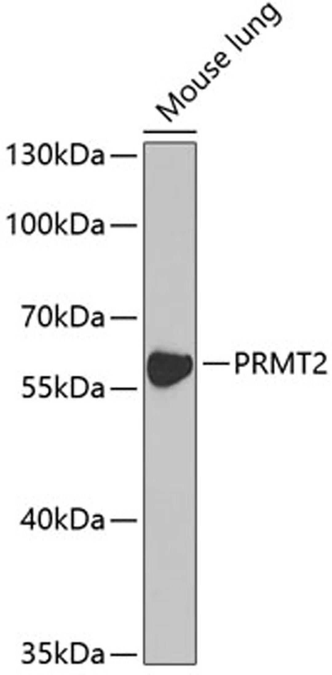 Western blot - PRMT2 antibody (A5835)