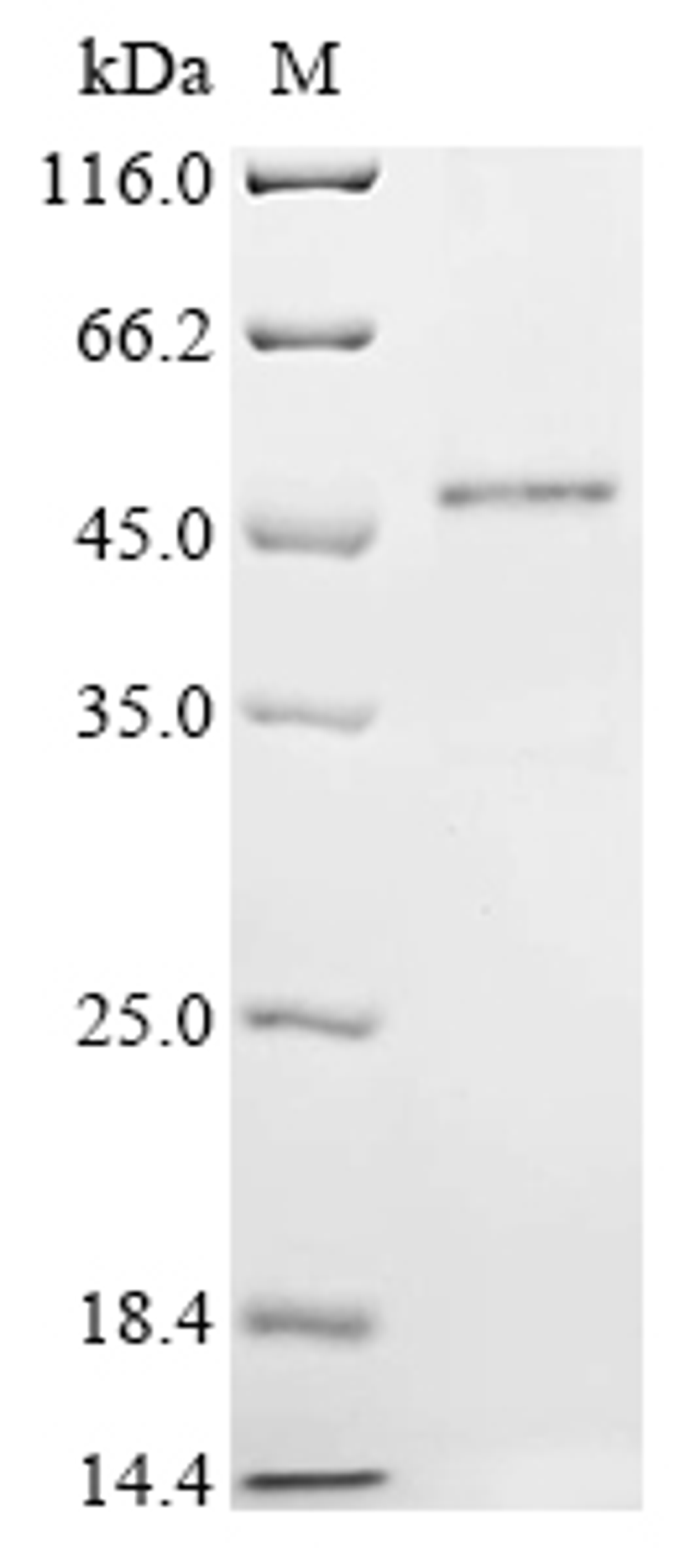(Tris-Glycine gel) Discontinuous SDS-PAGE (reduced) with 5% enrichment gel and 15% separation gel.