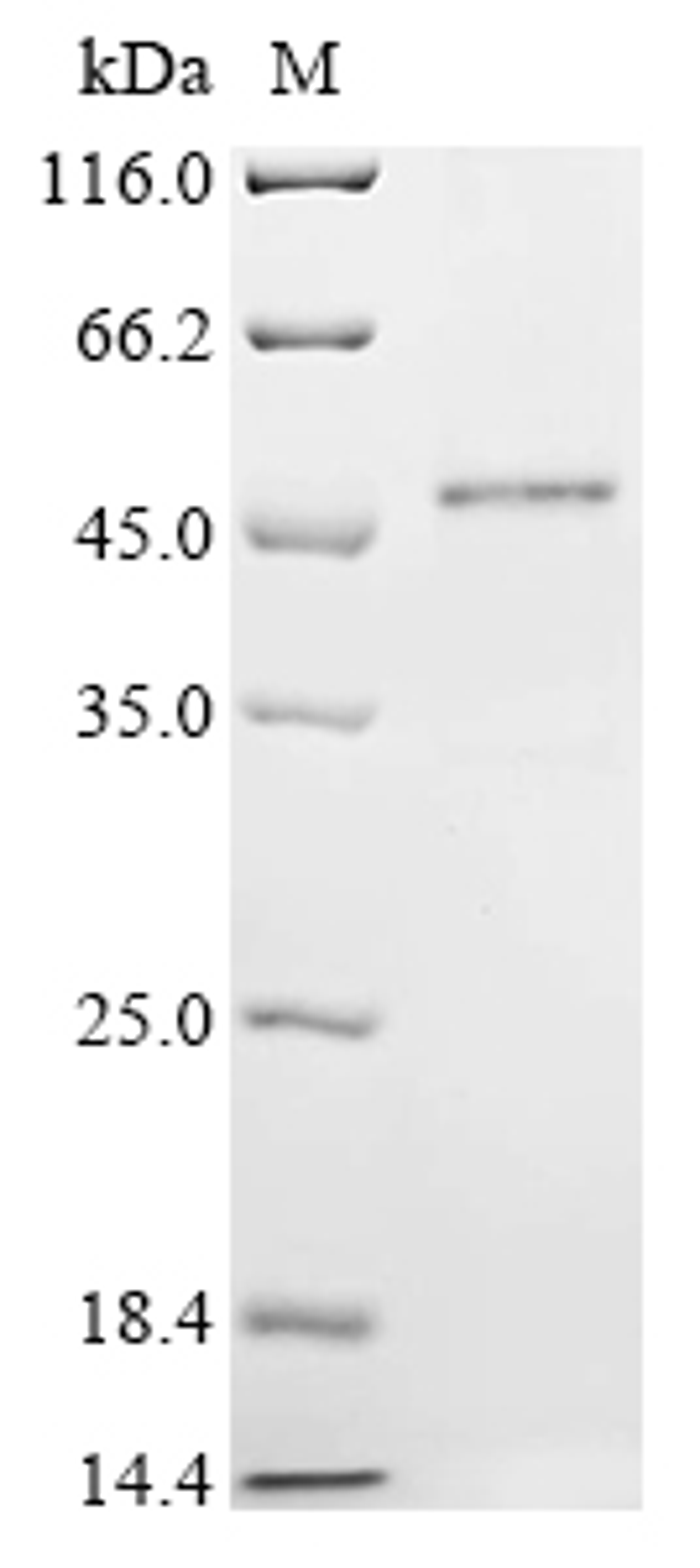 (Tris-Glycine gel) Discontinuous SDS-PAGE (reduced) with 5% enrichment gel and 15% separation gel.