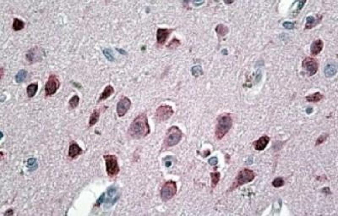 Immunohistochemistry-Paraffin: Neurogranin Antibody [NBP1-45219] - (3.8ug/ml) staining of paraffin embedded Human Cortex. Steamed antigen retrieval with citrate buffer pH 6, AP-staining.