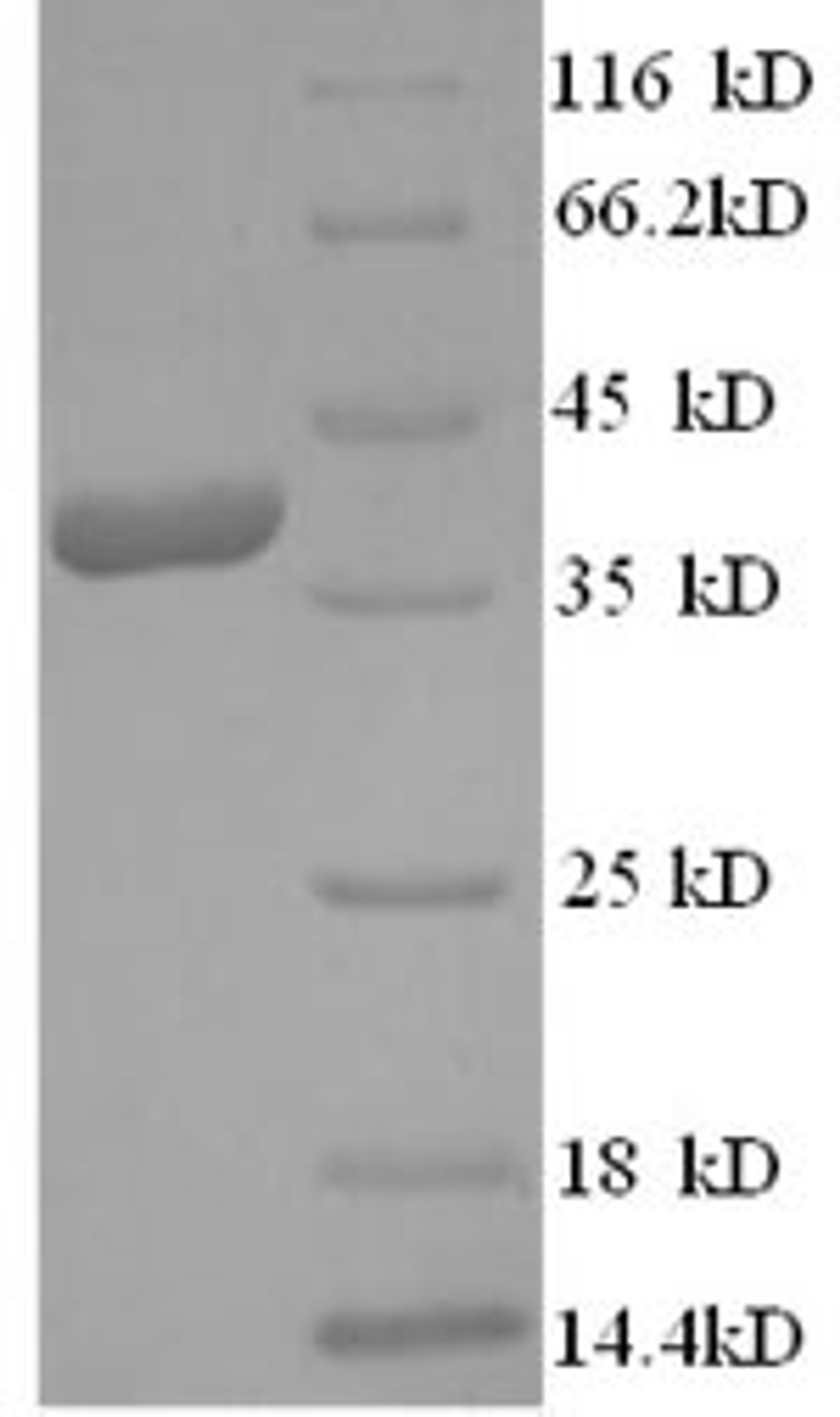 (Tris-Glycine gel) Discontinuous SDS-PAGE (reduced) with 5% enrichment gel and 15% separation gel.