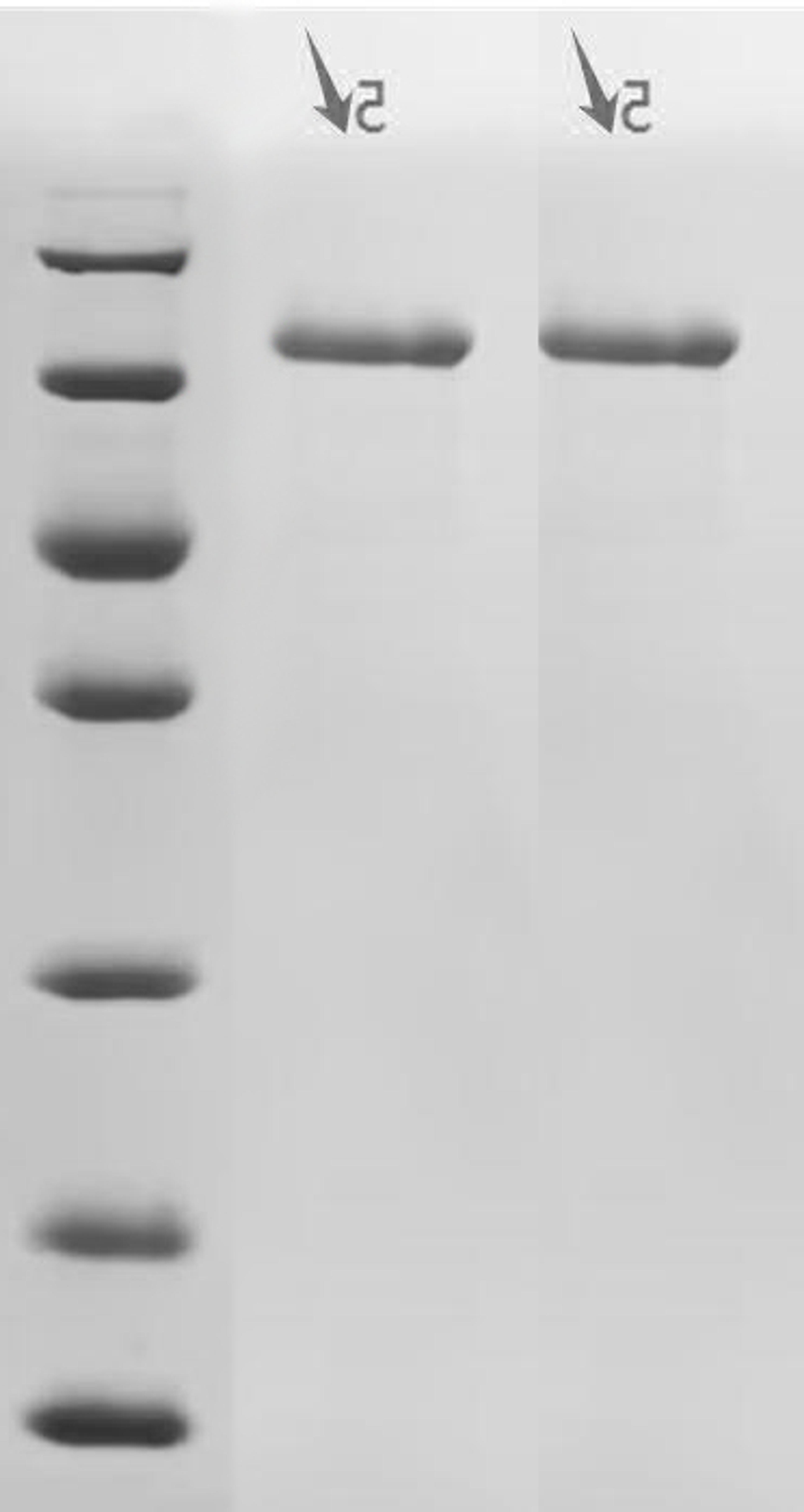 (Tris-Glycine gel) Discontinuous SDS-PAGE (reduced) with 5% enrichment gel and 15% separation gel.