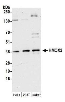 Detection of human HMOX2 by western blot.