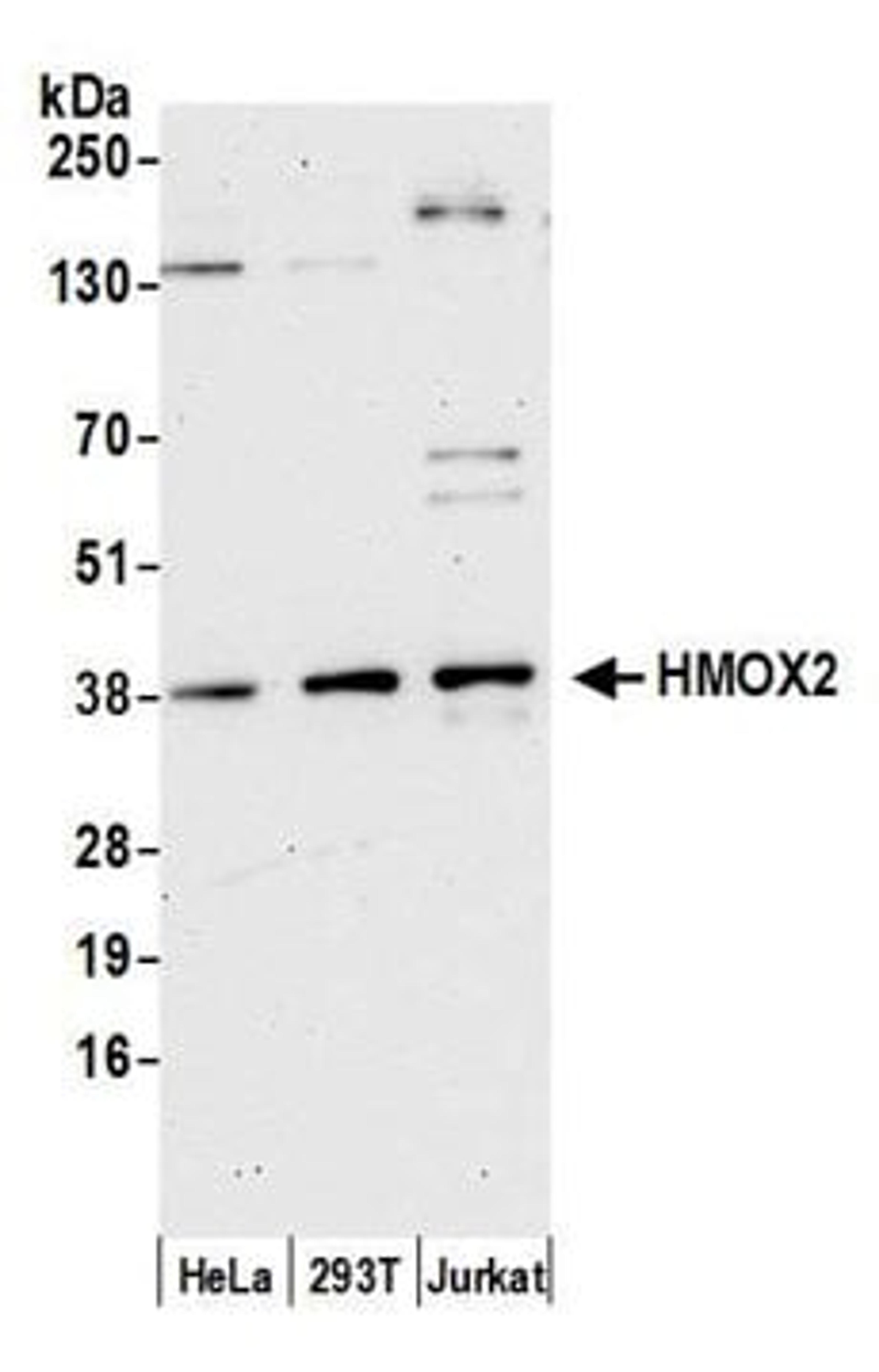 Detection of human HMOX2 by western blot.