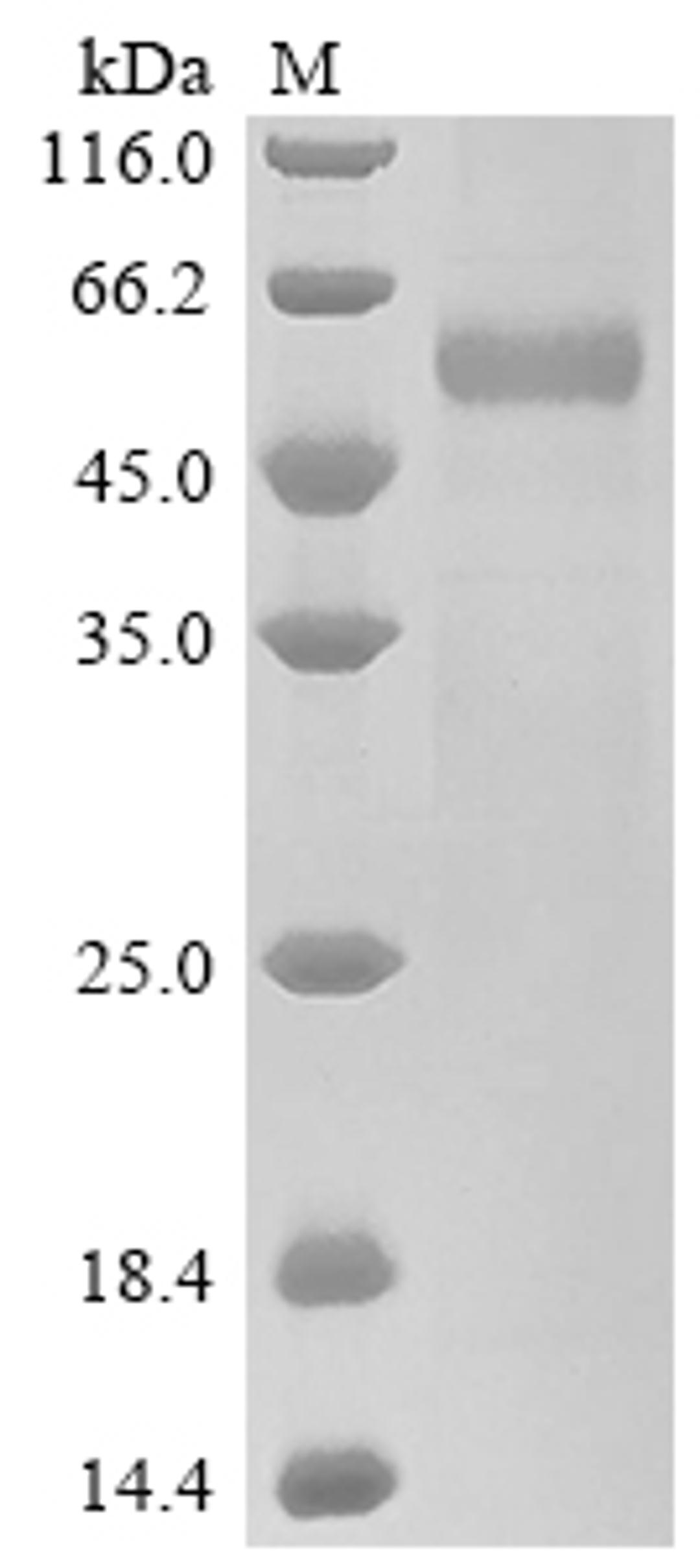 (Tris-Glycine gel) Discontinuous SDS-PAGE (reduced) with 5% enrichment gel and 15% separation gel.