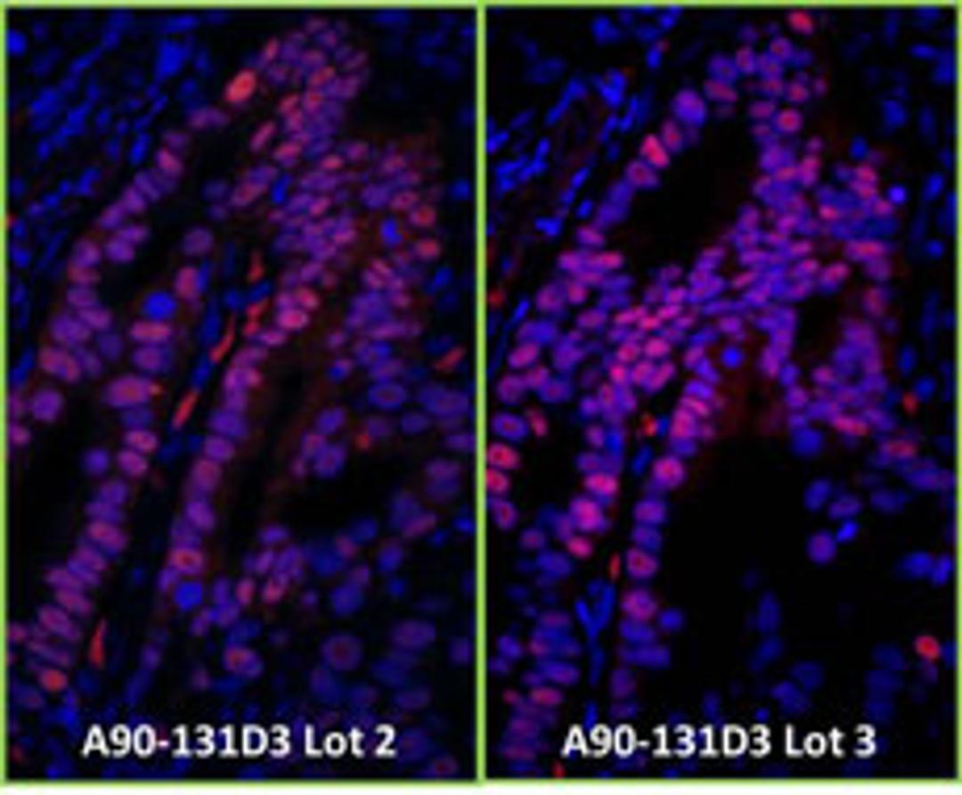 Detection of human p53 by immunofluorescence.