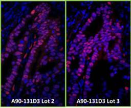 Detection of human p53 by immunofluorescence.