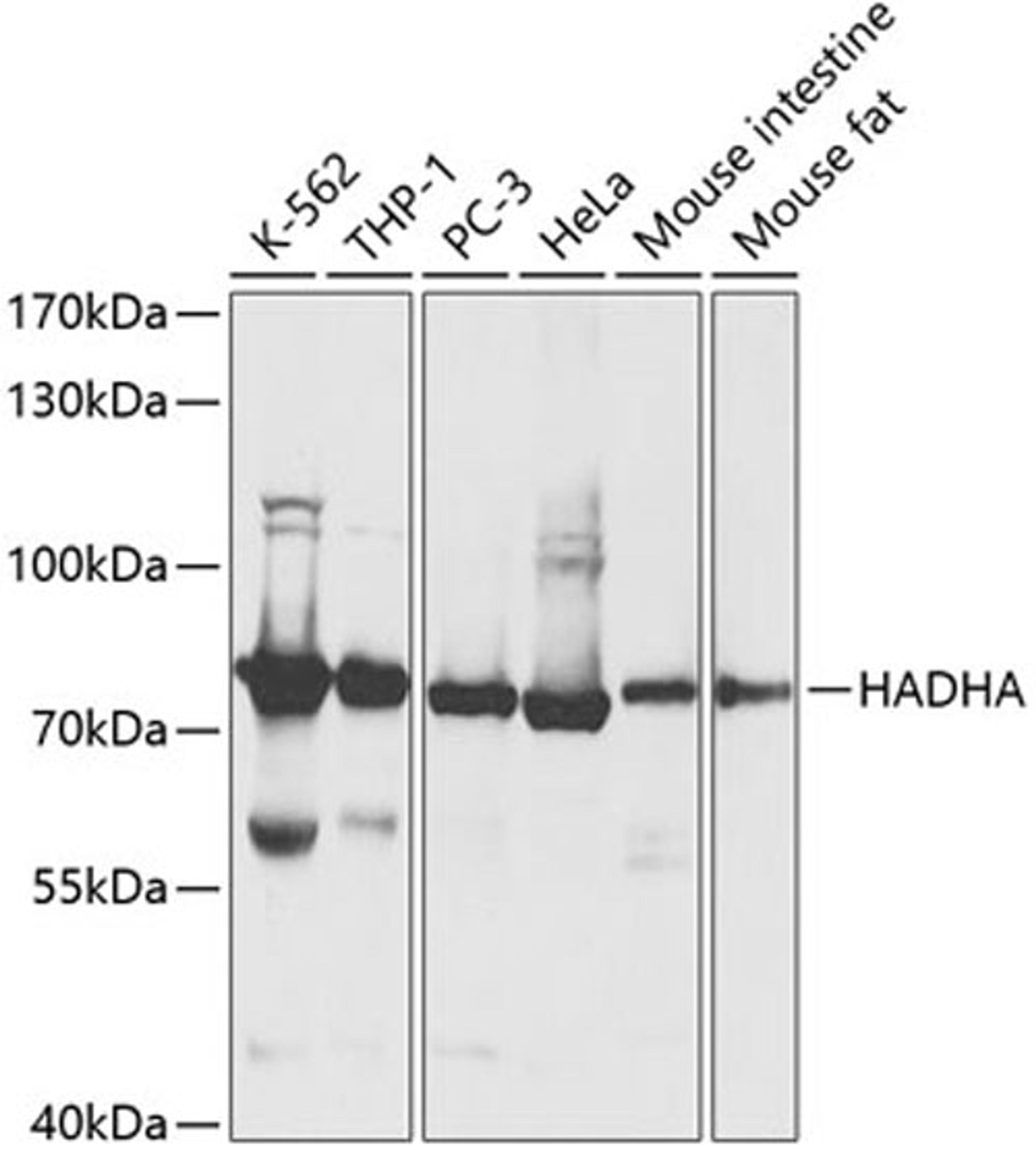 Western blot - HADHA antibody (A13310)