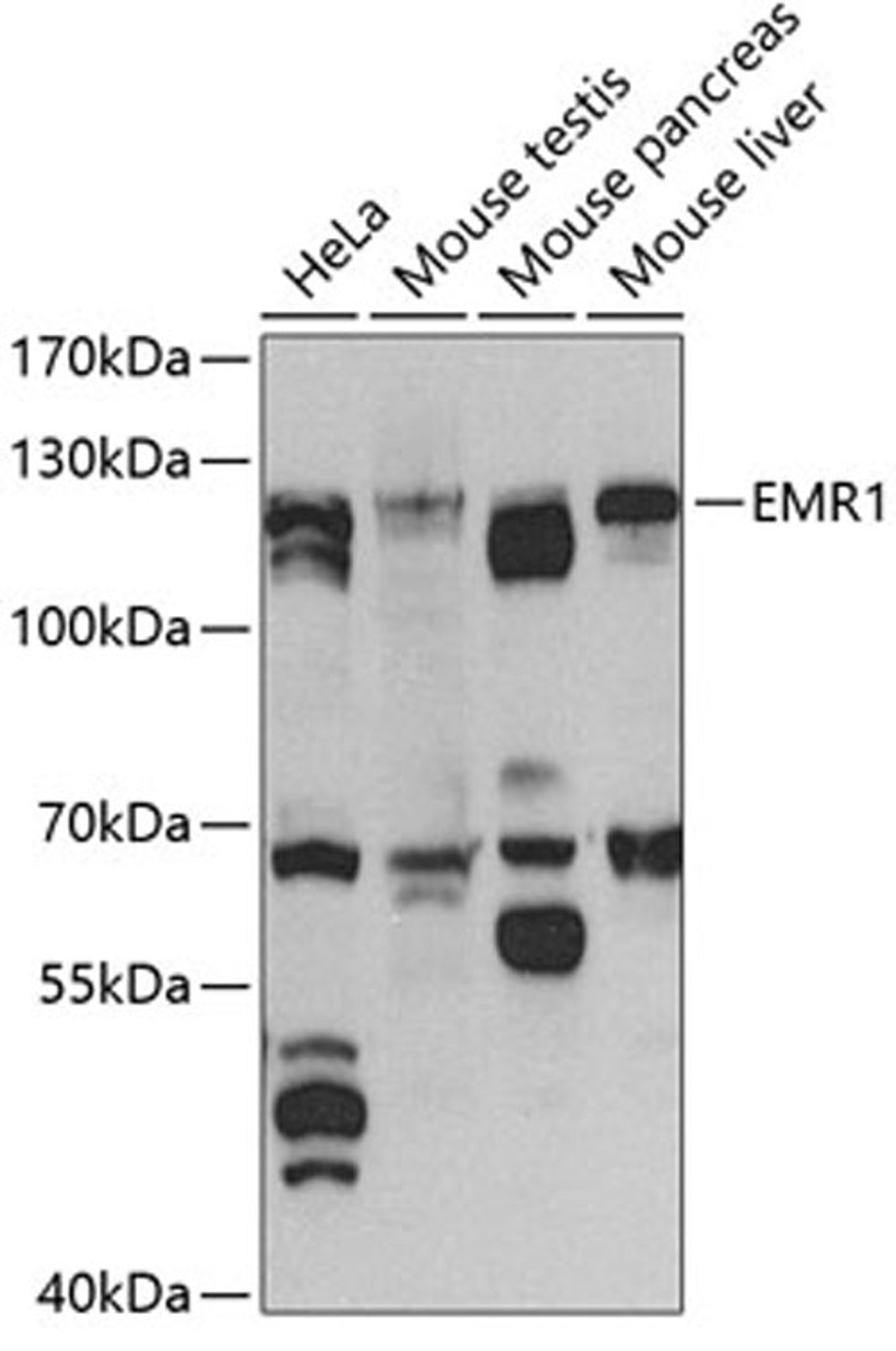 Western blot - EMR1 antibody (A1256)