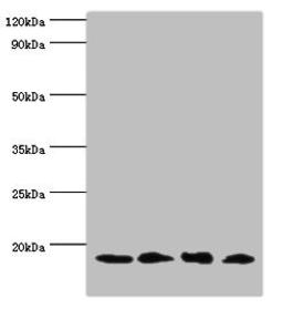 Western blot. All lanes: UBE2V2 antibody at 3µg/ml. Lane 1: Hela whole cell lysate. Lane 2: Mouse brain tissue. Lane 3: Jurkat whole cell lysate. Lane 4: K562 whole cell lysate. Secondary. Goat polyclonal to rabbit IgG at 1/10000 dilution. Predicted band size: 16 kDa. Observed band size: 16 kDa