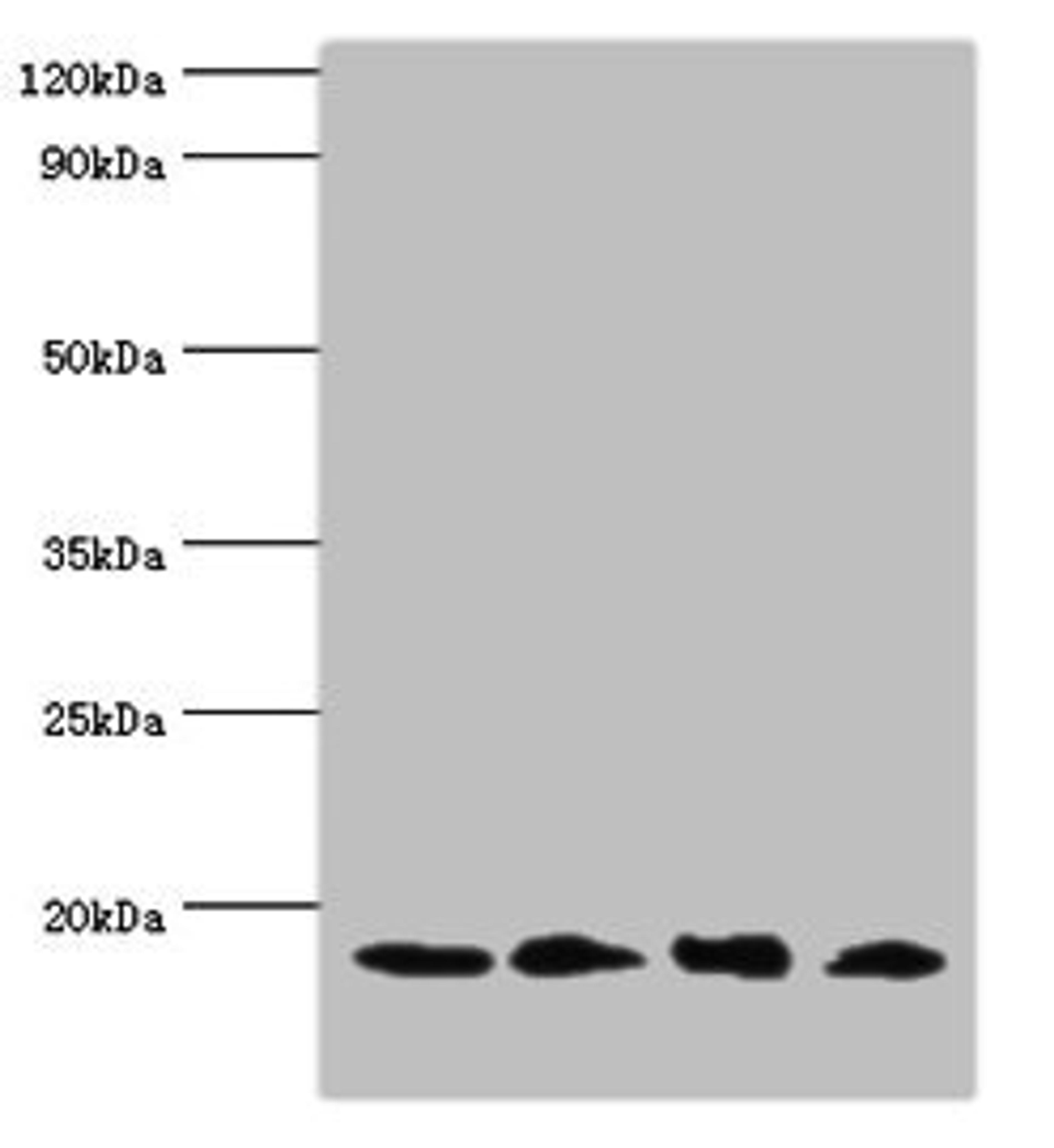 Western blot. All lanes: UBE2V2 antibody at 3µg/ml. Lane 1: Hela whole cell lysate. Lane 2: Mouse brain tissue. Lane 3: Jurkat whole cell lysate. Lane 4: K562 whole cell lysate. Secondary. Goat polyclonal to rabbit IgG at 1/10000 dilution. Predicted band size: 16 kDa. Observed band size: 16 kDa