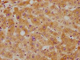 IHC image of CSB-RA005267A0HU diluted at 1:115 and staining in paraffin-embedded human liver tissue performed on a Leica BondTM system. After dewaxing and hydration, antigen retrieval was mediated by high pressure in a citrate buffer (pH 6.0). Section was blocked with 10% normal goat serum 30min at RT. Then primary antibody (1% BSA) was incubated at 4℃ overnight. The primary is detected by a biotinylated secondary antibody and visualized using an HRP conjugated SP system.