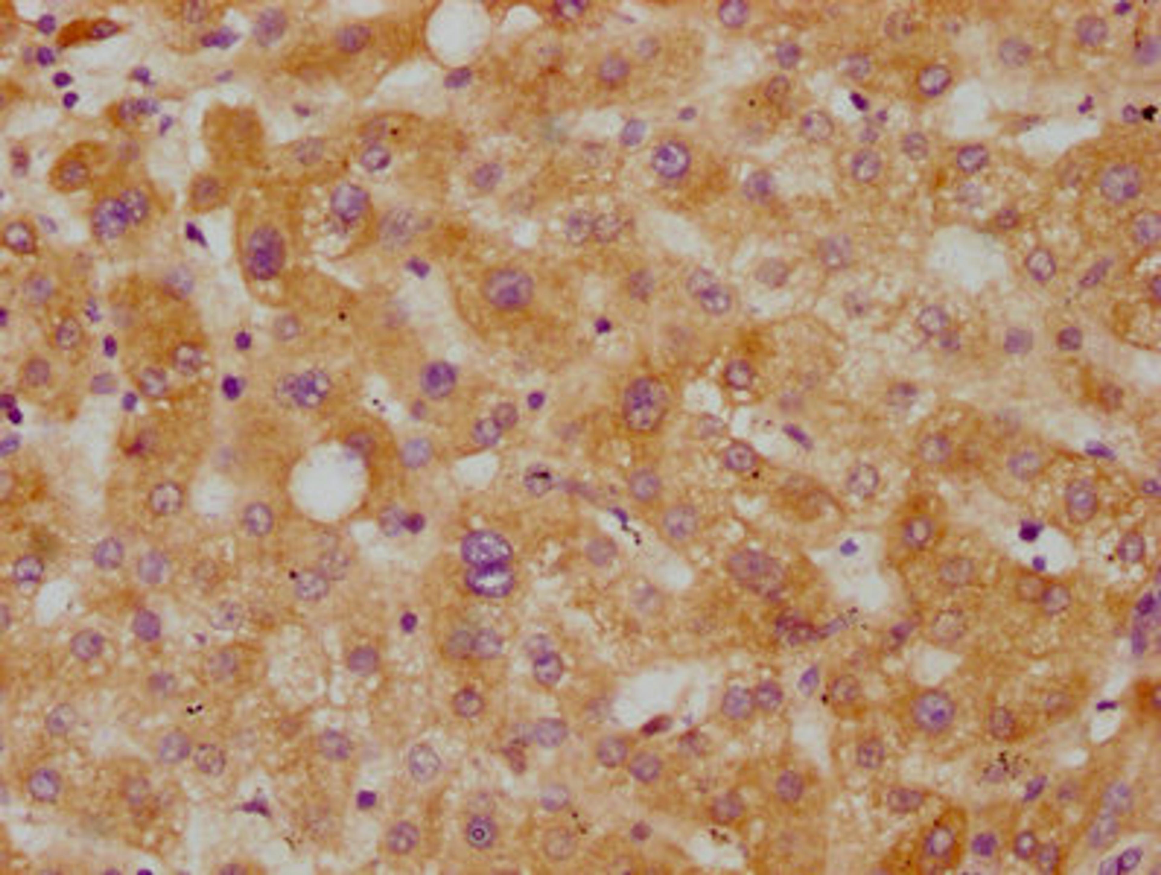 IHC image of CSB-RA005267A0HU diluted at 1:115 and staining in paraffin-embedded human liver tissue performed on a Leica BondTM system. After dewaxing and hydration, antigen retrieval was mediated by high pressure in a citrate buffer (pH 6.0). Section was blocked with 10% normal goat serum 30min at RT. Then primary antibody (1% BSA) was incubated at 4℃ overnight. The primary is detected by a biotinylated secondary antibody and visualized using an HRP conjugated SP system.