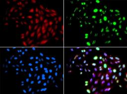 Immunofluorescence analysis of GFP-RNF168 trangenic U2OS cell using RAD51L1 antibody