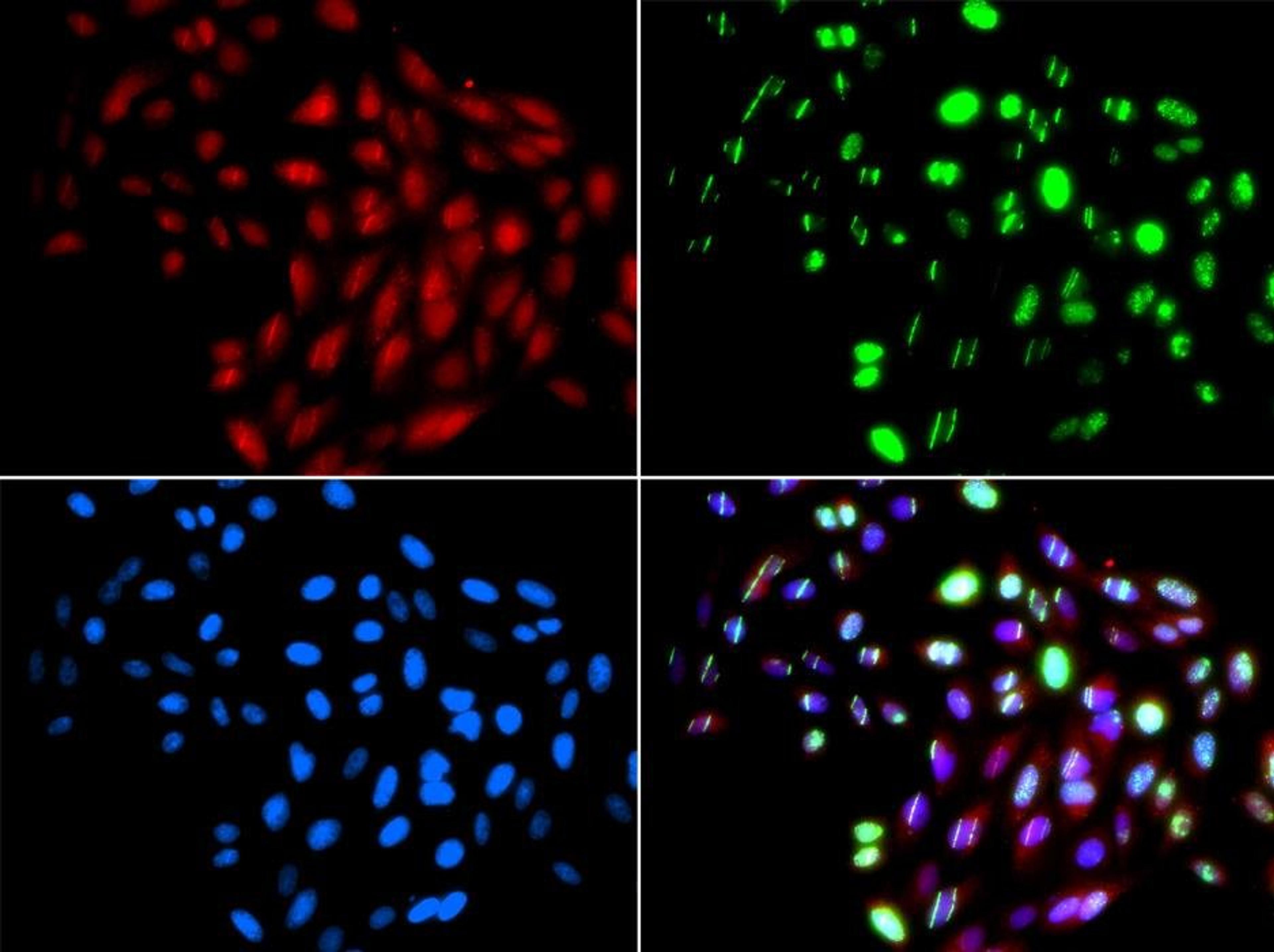 Immunofluorescence analysis of GFP-RNF168 trangenic U2OS cell using RAD51L1 antibody