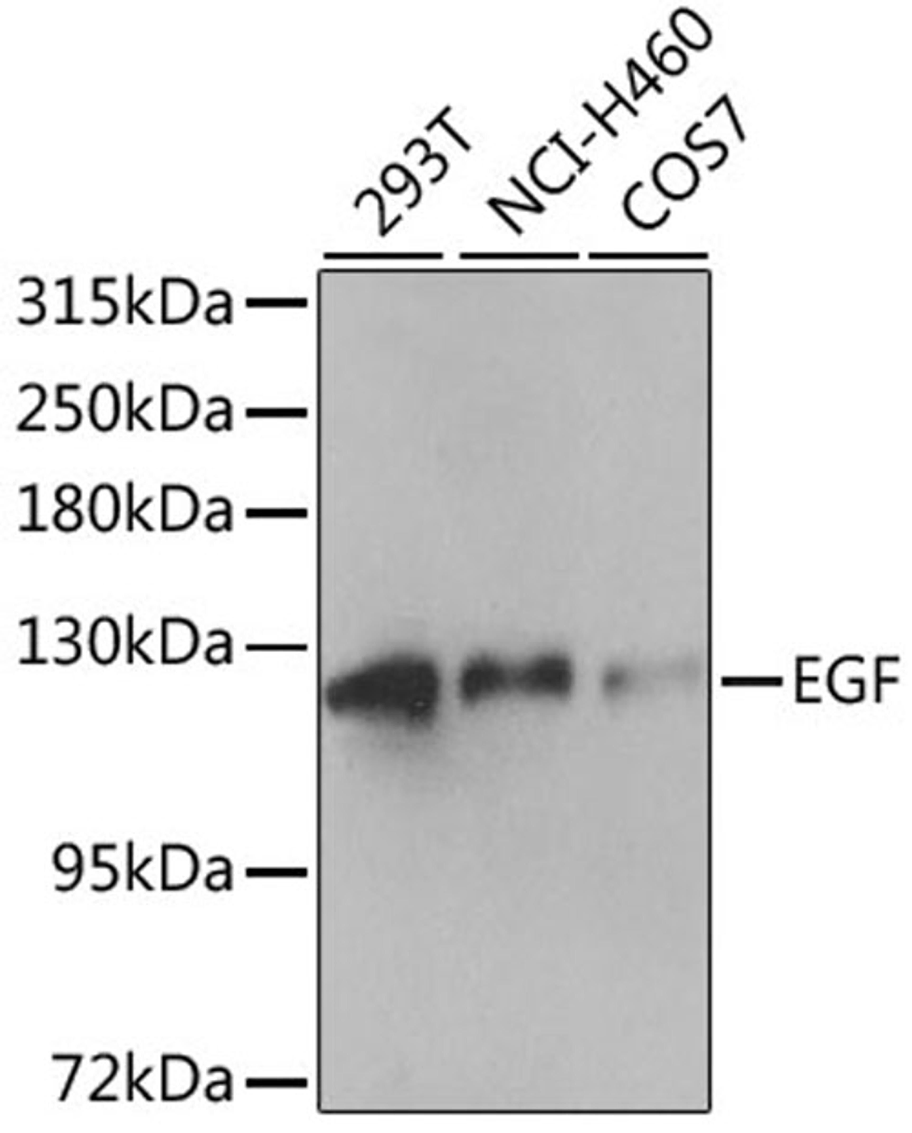 Western blot - EGF antibody (A13615)