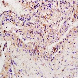 Paraffin-embedded rat colitis tissue fixed with 4% paraformaldehyde. Antigen retrieval by boiling with citrate buffer. Blocking buffer is goat serum (37 degrees for 20 min.). IRF1 antibody at 1:200 dilution with overnight incubation at 4 degrees