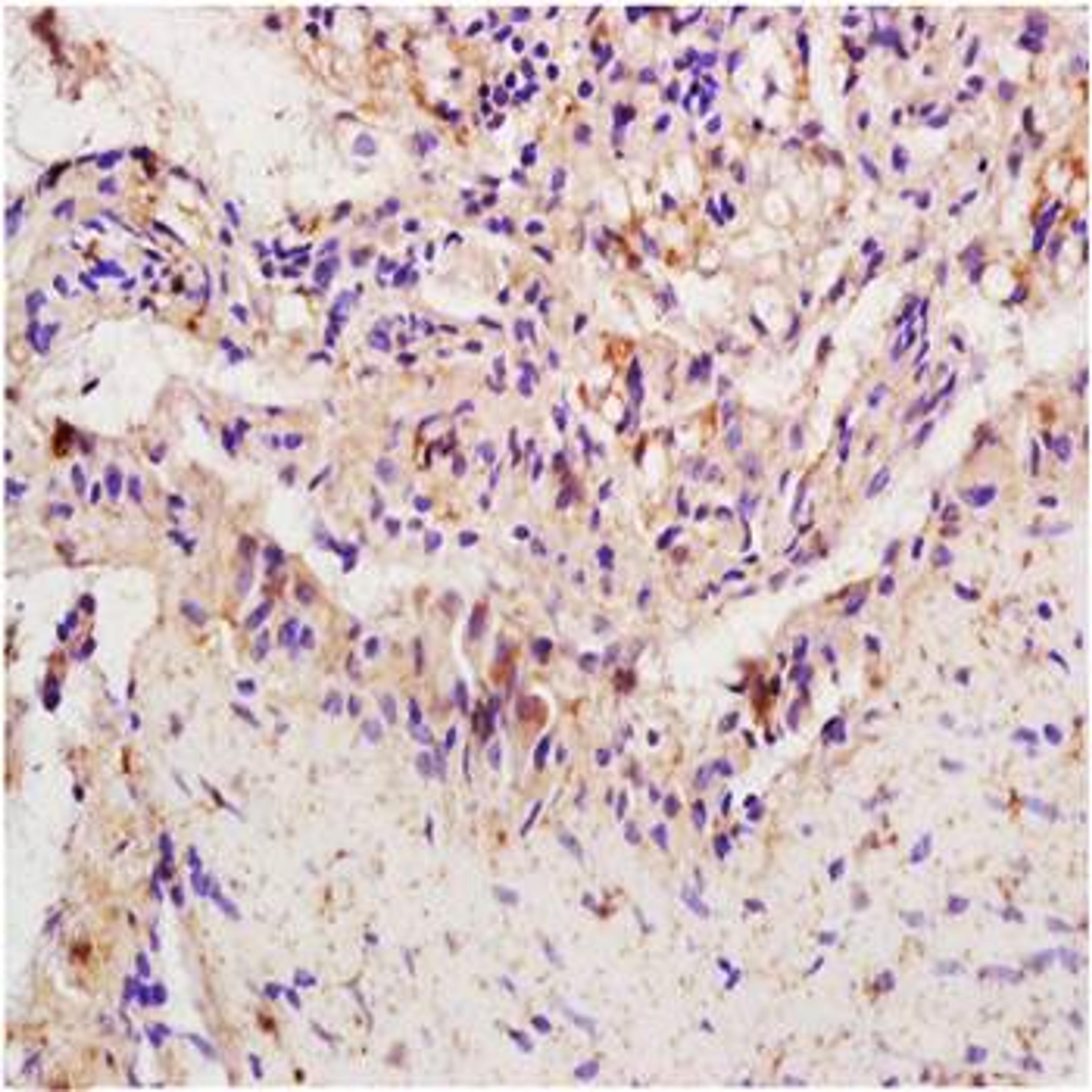 Paraffin-embedded rat colitis tissue fixed with 4% paraformaldehyde. Antigen retrieval by boiling with citrate buffer. Blocking buffer is goat serum (37 degrees for 20 min.). IRF1 antibody at 1:200 dilution with overnight incubation at 4 degrees