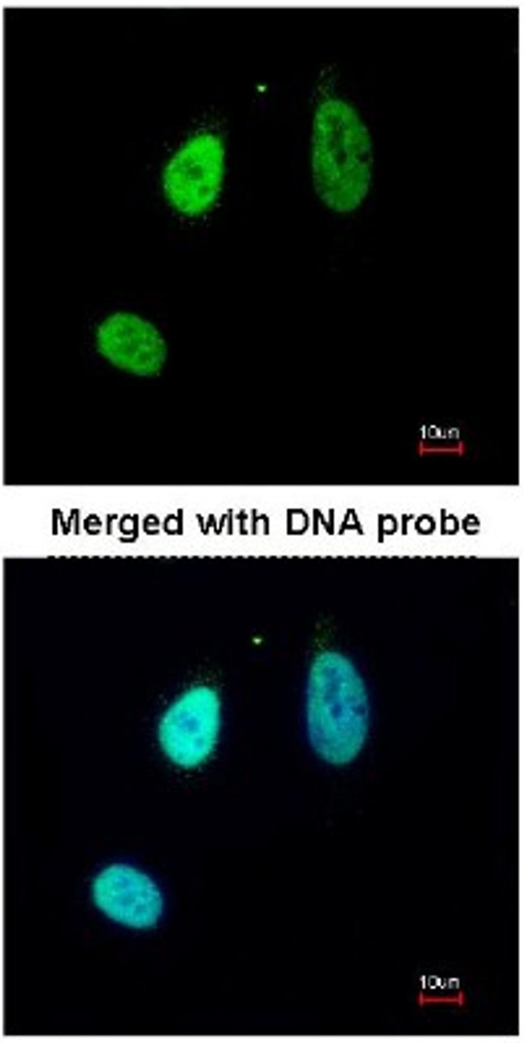 Immunocytochemistry/Immunofluorescence: ERG Antibody [NBP1-31370] - Analysis of HeLa, using NBP1-31370 at 1:200 dilution.