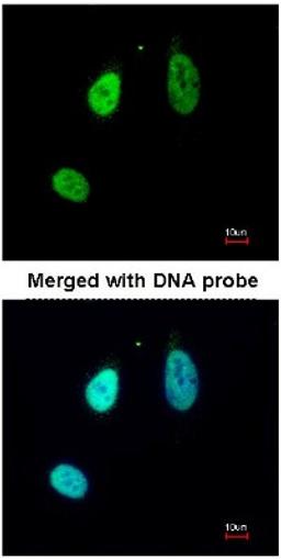 Immunocytochemistry/Immunofluorescence: ERG Antibody [NBP1-31370] - Analysis of HeLa, using NBP1-31370 at 1:200 dilution.