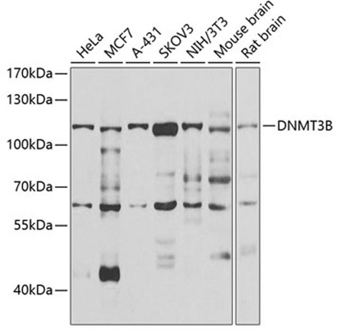 Western blot - DNMT3B antibody (A7239)