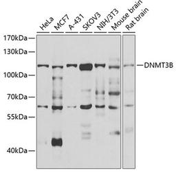 Western blot - DNMT3B antibody (A7239)