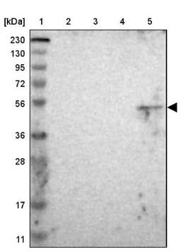 Western Blot: LASS3 Antibody [NBP1-84536] - Lane 1: Marker [kDa] 230, 130, 95, 72, 56, 36, 28, 17, 11<br/>Lane 2: Human cell line RT-4<br/>Lane 3: Human cell line U-251MG sp<br/>Lane 4: Human plasma (IgG/HSA depleted)<br/>Lane 5: Human liver tissue