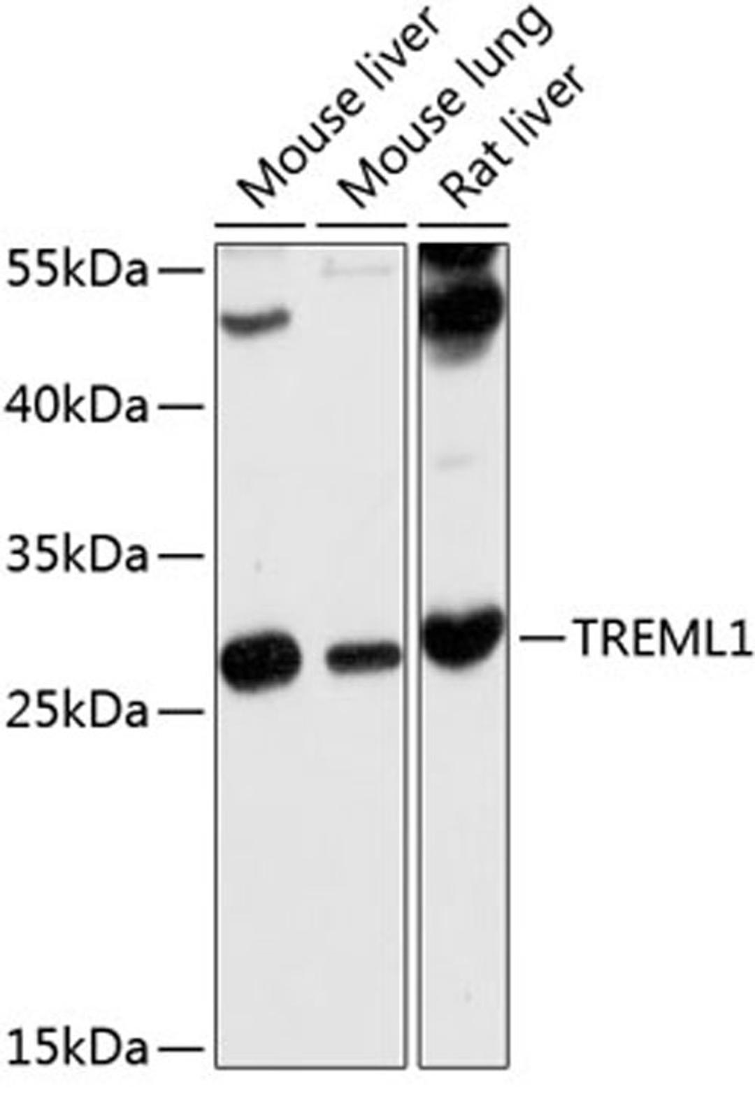 Western blot - TREML1 antibody (A10414)