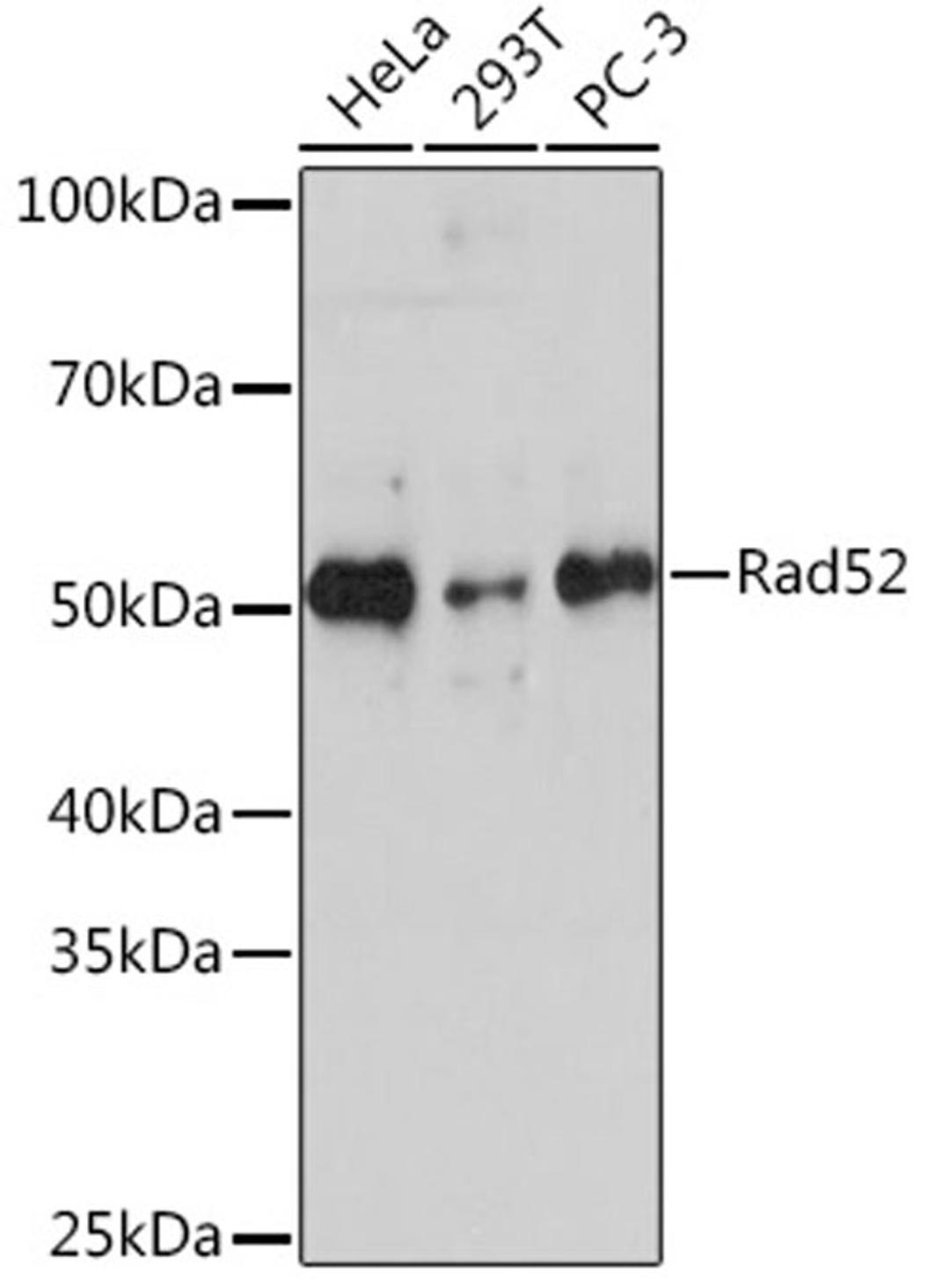 Western blot - Rad52 Rabbit mAb (A5186)