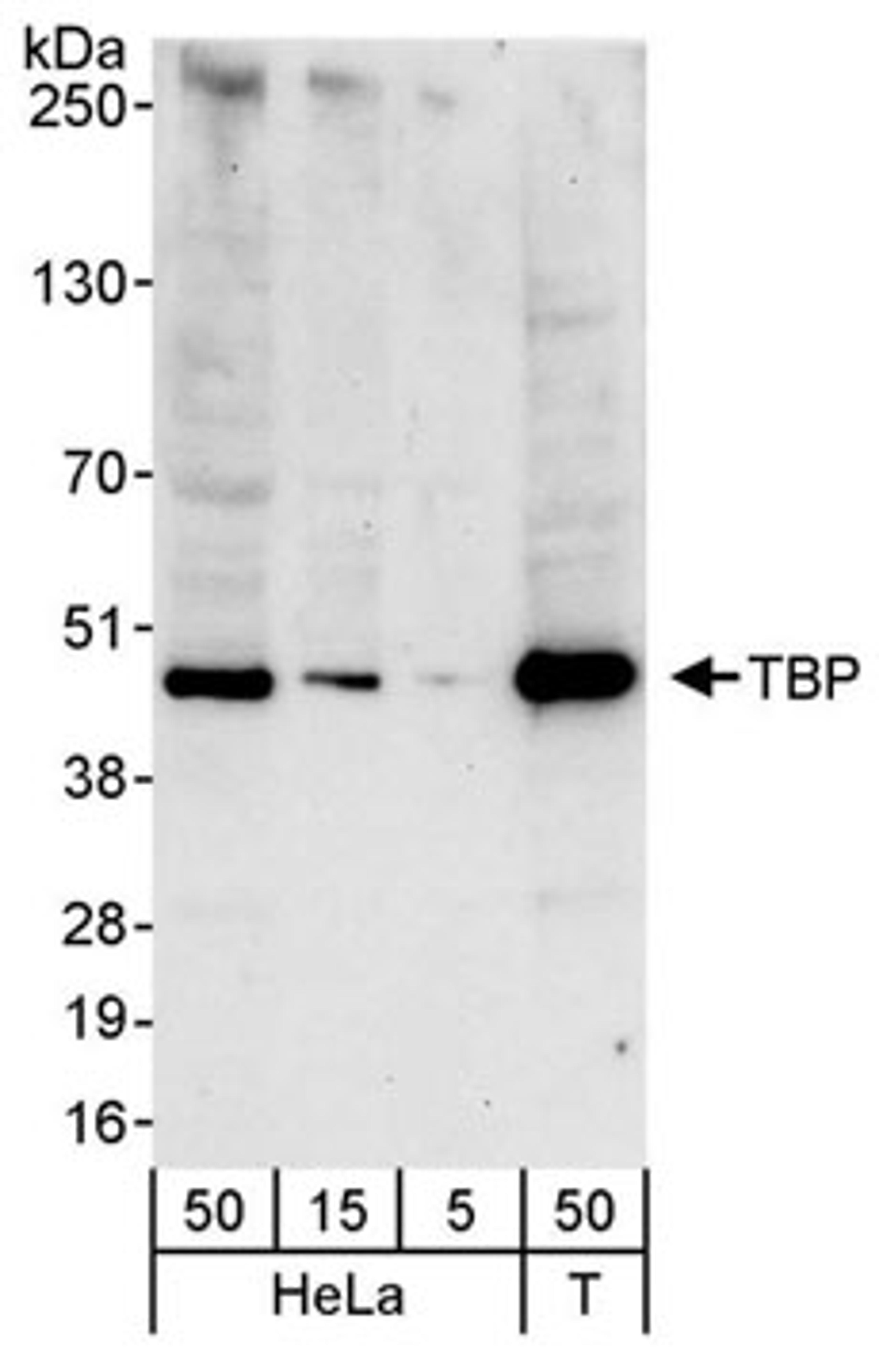 Detection of human TBP by western blot.