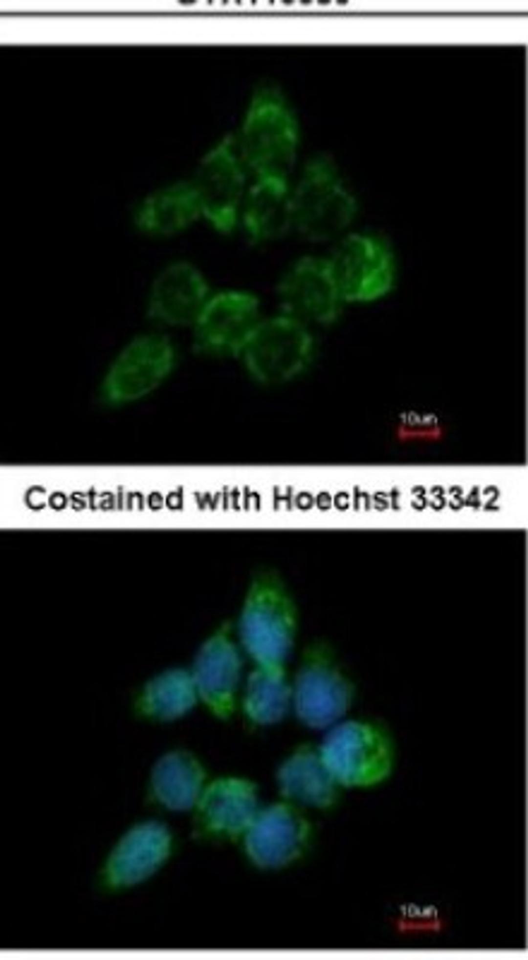 Immunocytochemistry/Immunofluorescence: ETEA Antibody [NBP2-16381] - Analysis of methanol-fixed A431, using antibody at 1:200 dilution.