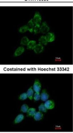 Immunocytochemistry/Immunofluorescence: ETEA Antibody [NBP2-16381] - Analysis of methanol-fixed A431, using antibody at 1:200 dilution.