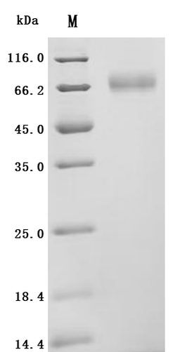 (Tris-Glycine gel) Discontinuous SDS-PAGE (reduced) with 5% enrichment gel and 15% separation gel.