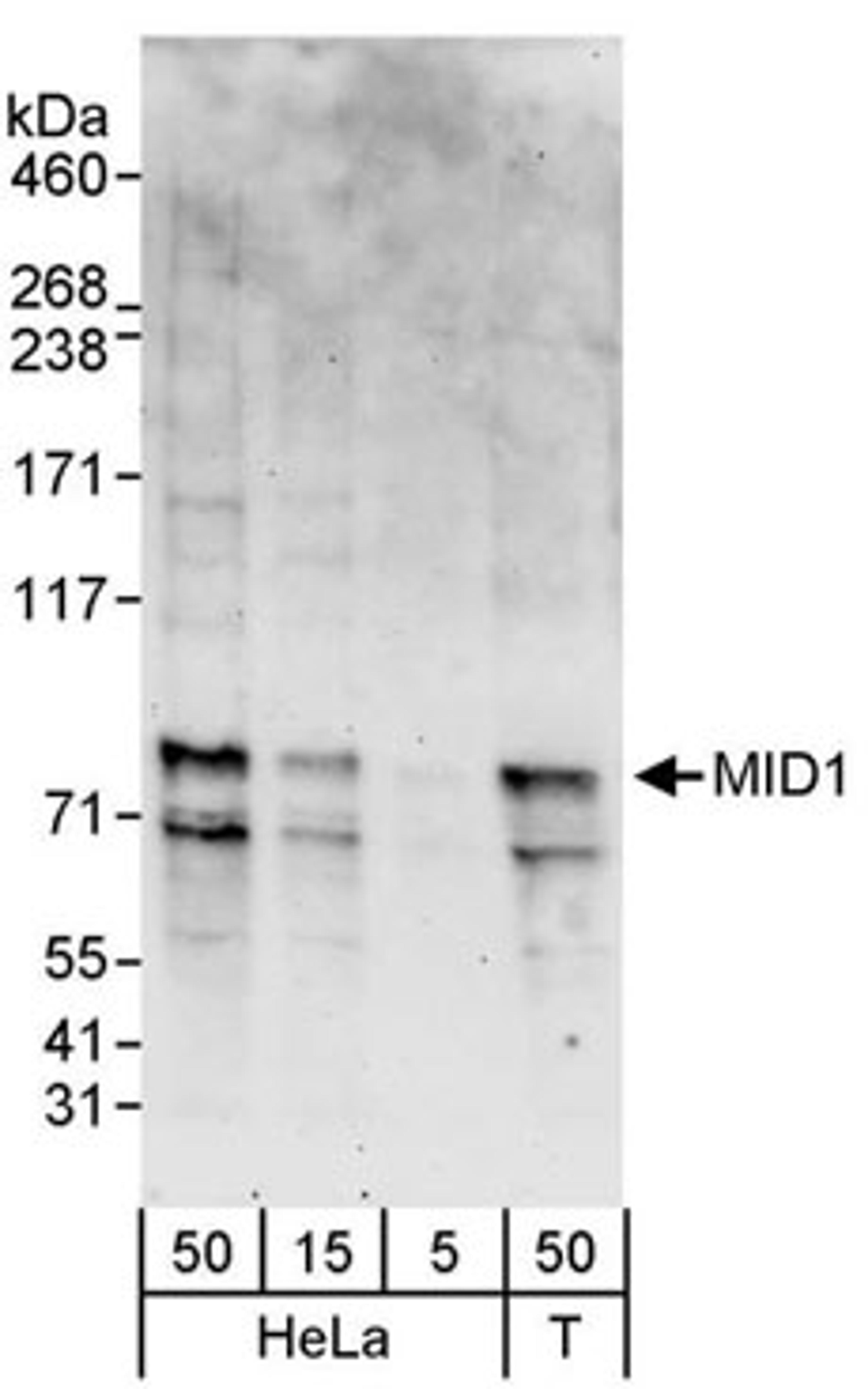 Detection of human MID1 by western blot.