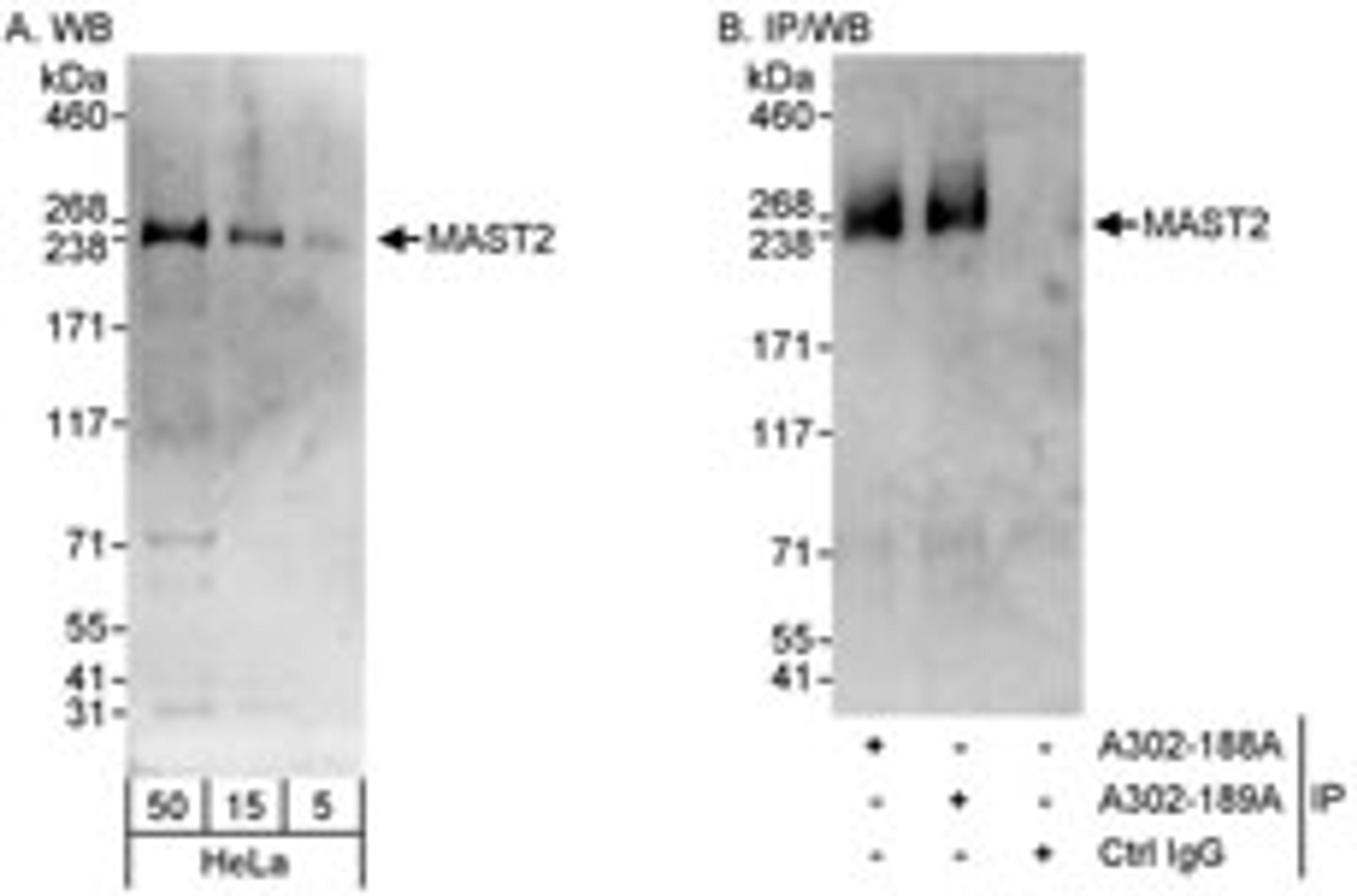 Detection of human MAST2 by western blot and immunoprecipitation.