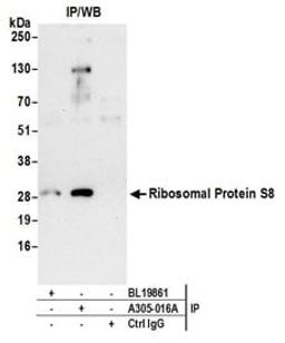 Detection of human Ribosomal Protein S8 by western blot of immunoprecipitates.