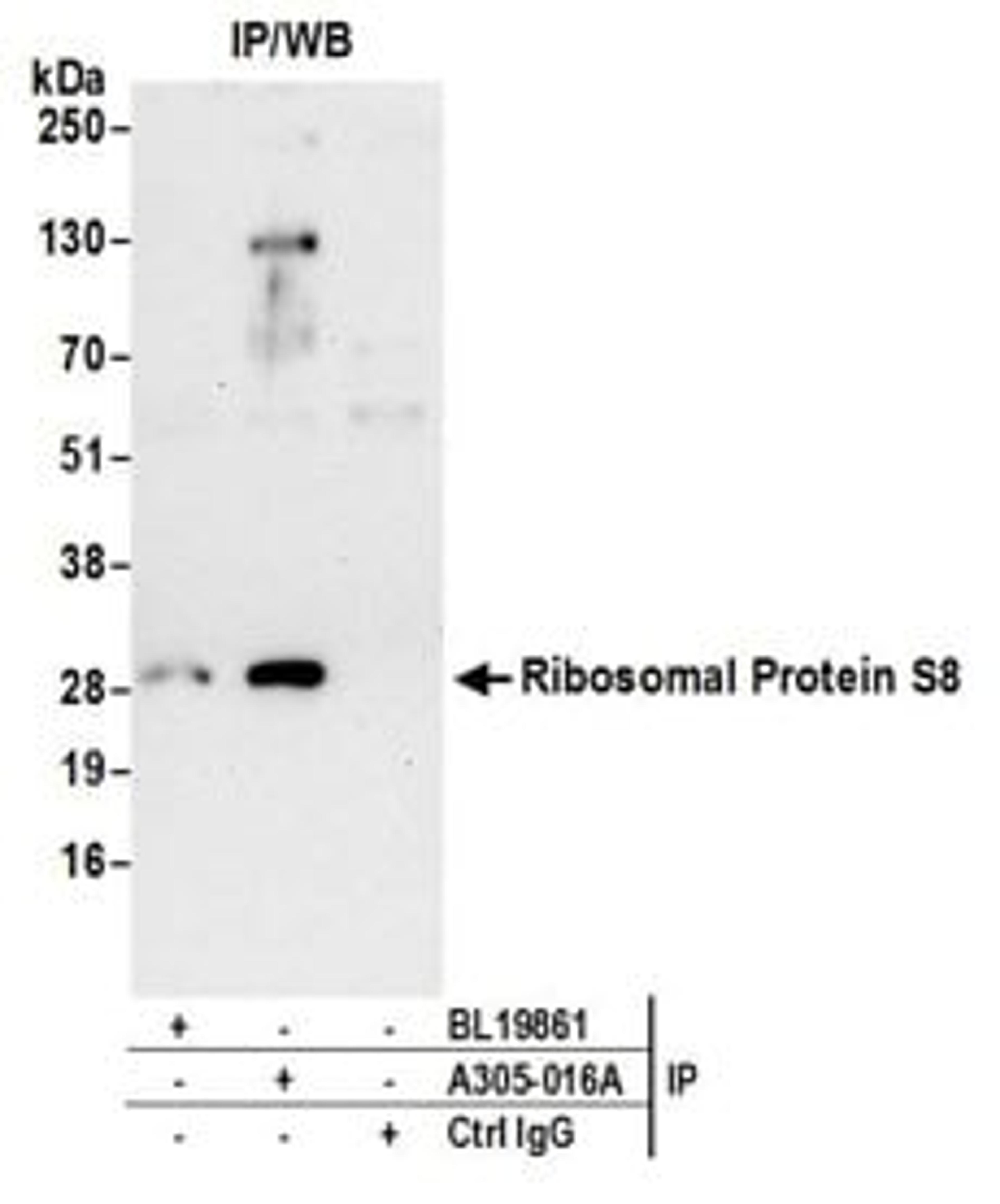 Detection of human Ribosomal Protein S8 by western blot of immunoprecipitates.