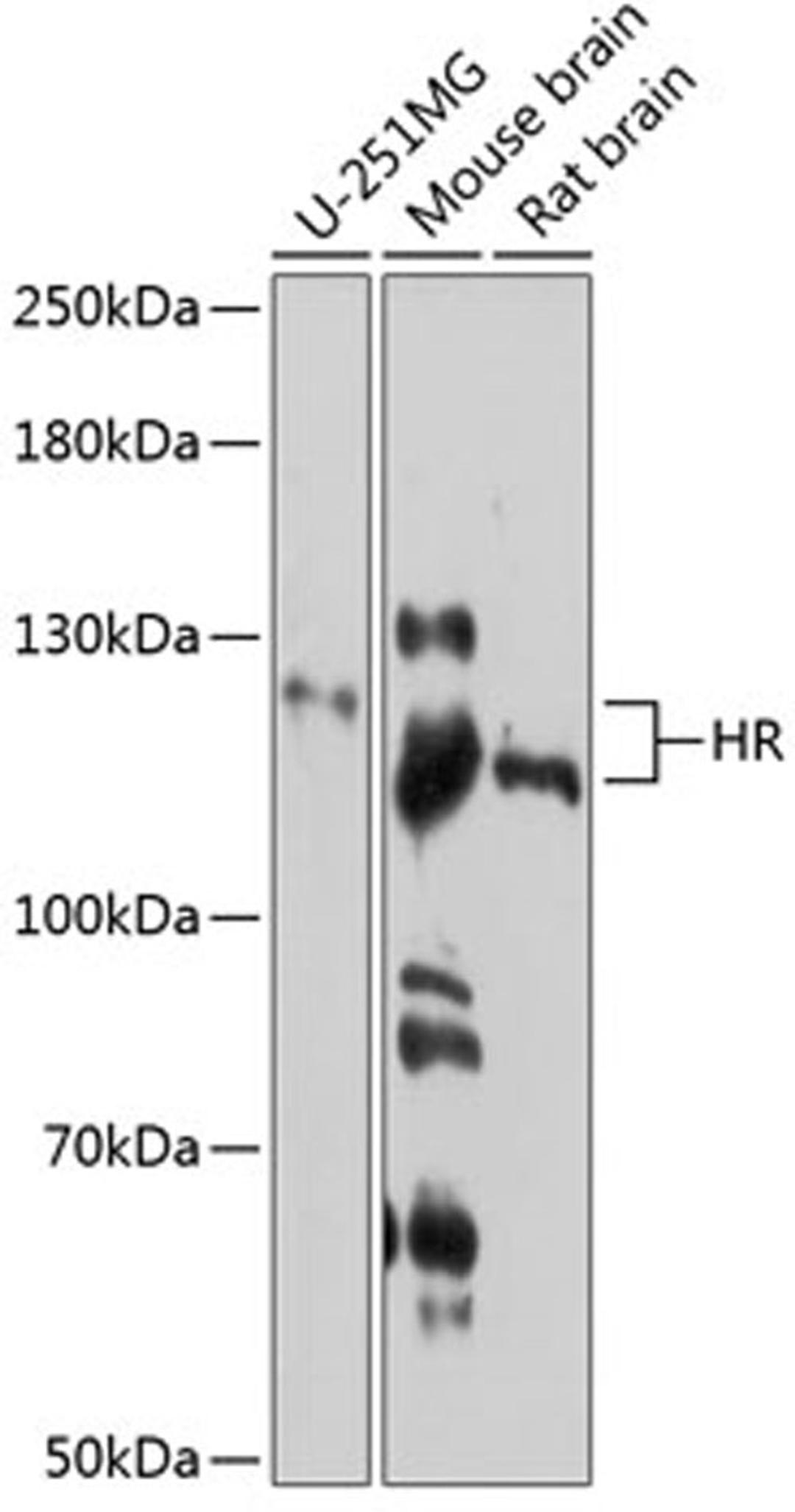 Western blot - HR antibody (A11996)