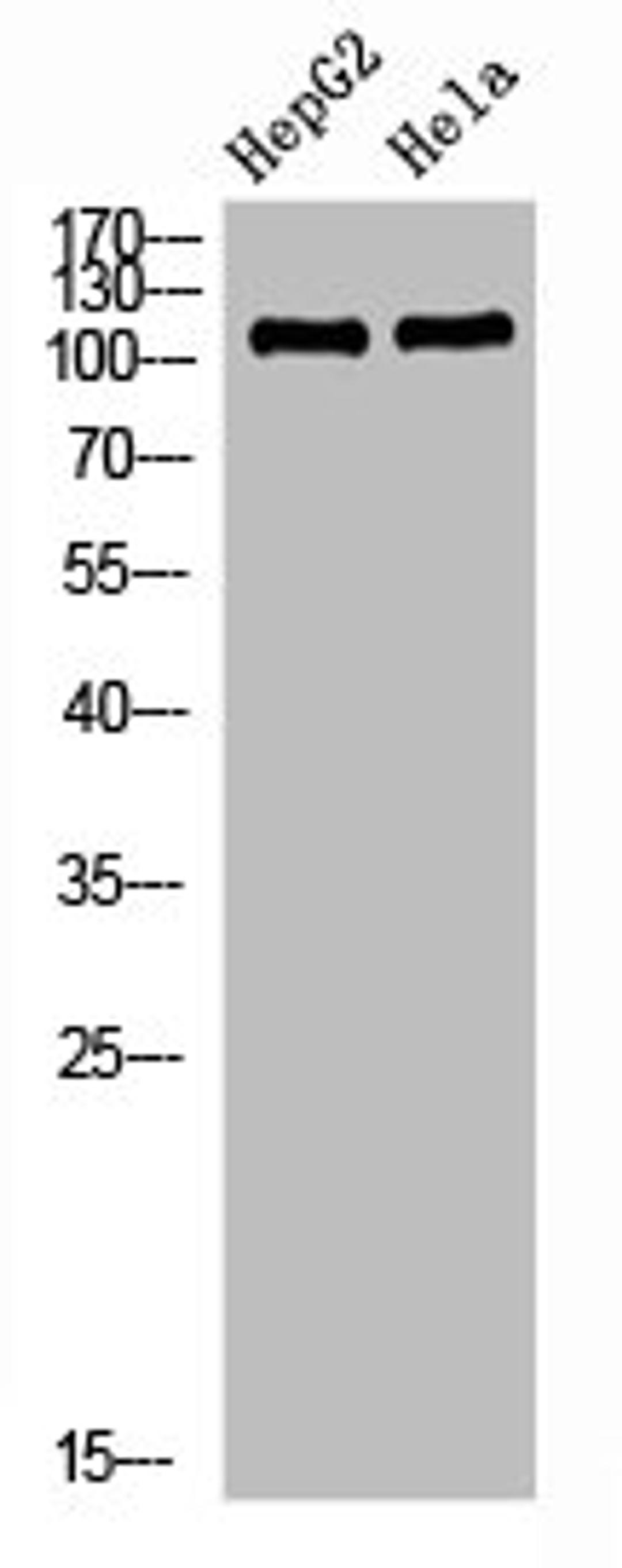 Western Blot analysis of HEPG2 Hela cells using NLRX1 Polyclonal Antibody diluted at 1:1000. Secondary antibody  was diluted at 1:20000