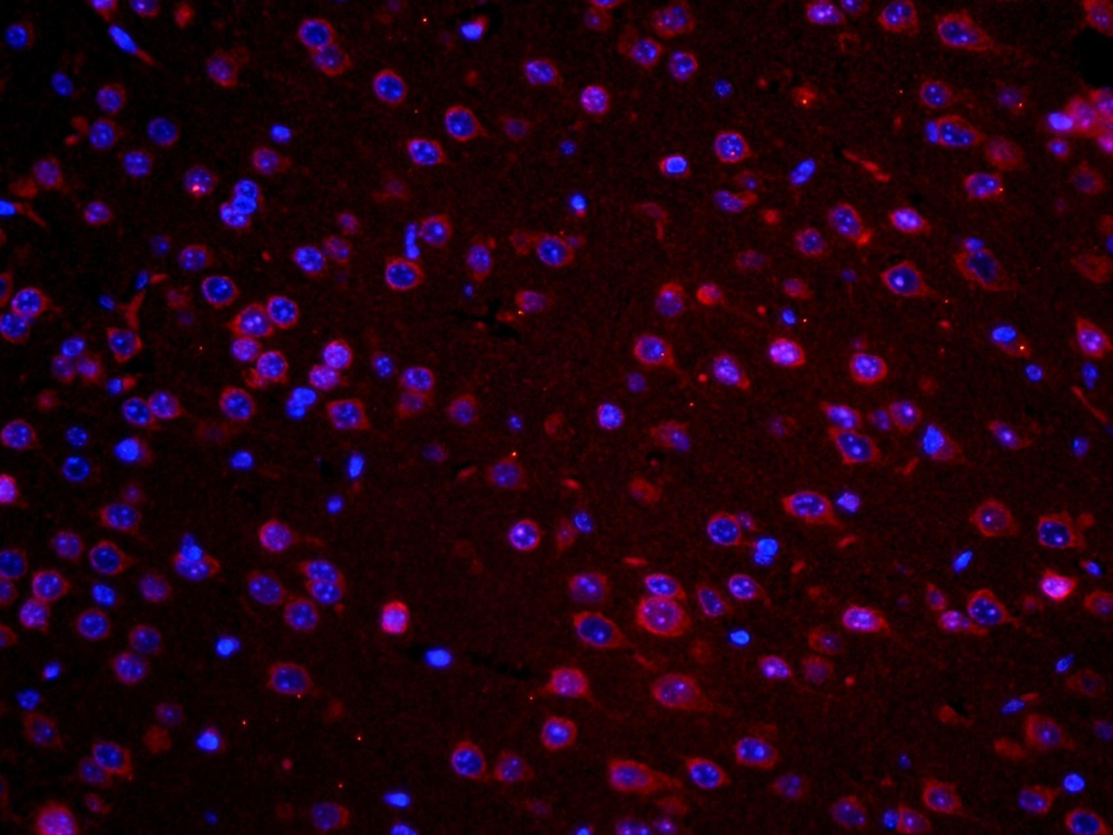 IF image of mouse brain tissue using anti-GM1(GS) (primary antibody at 5 ug/ml)