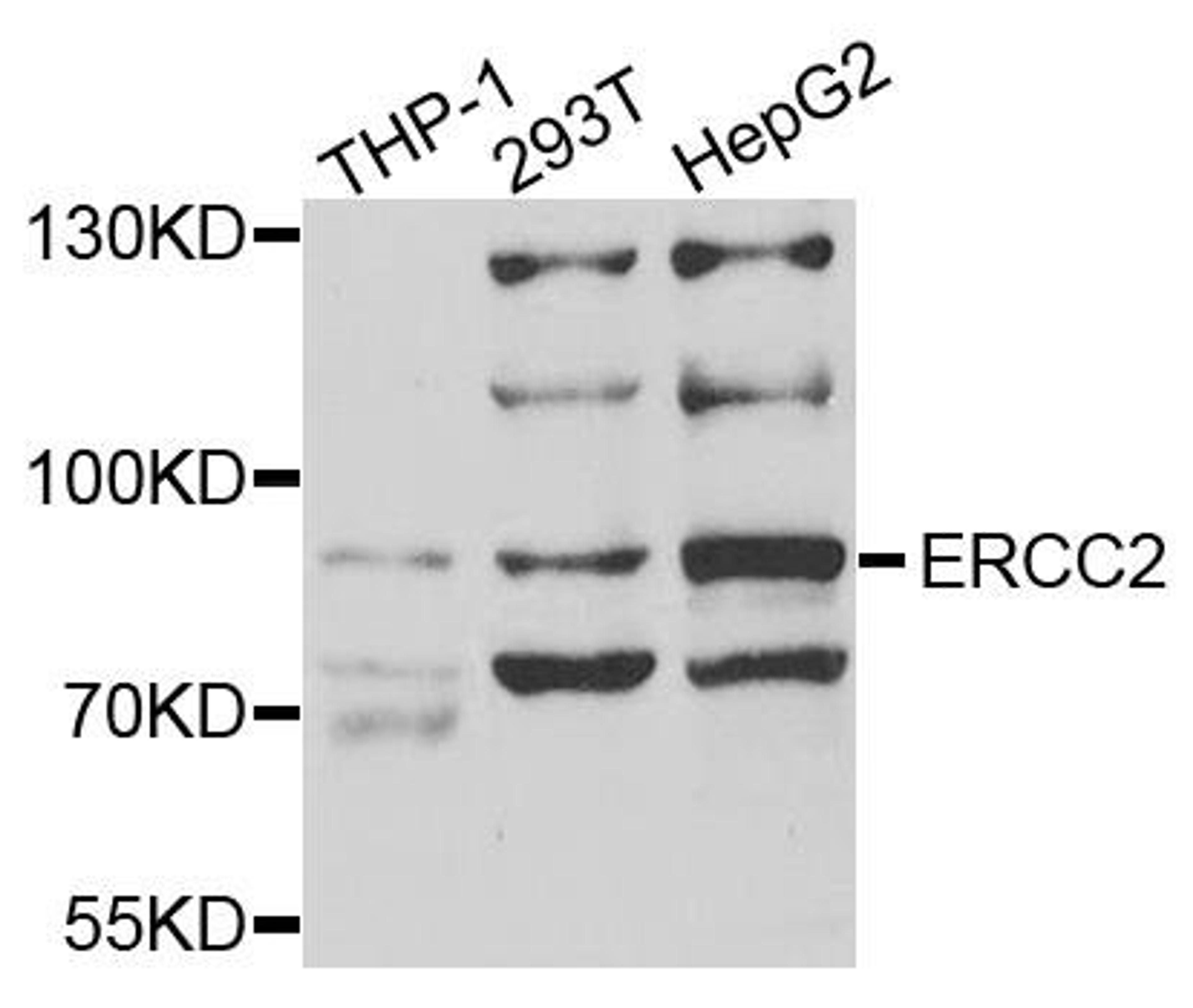 Western blot analysis of extracts of various cells using ERCC2 antibody