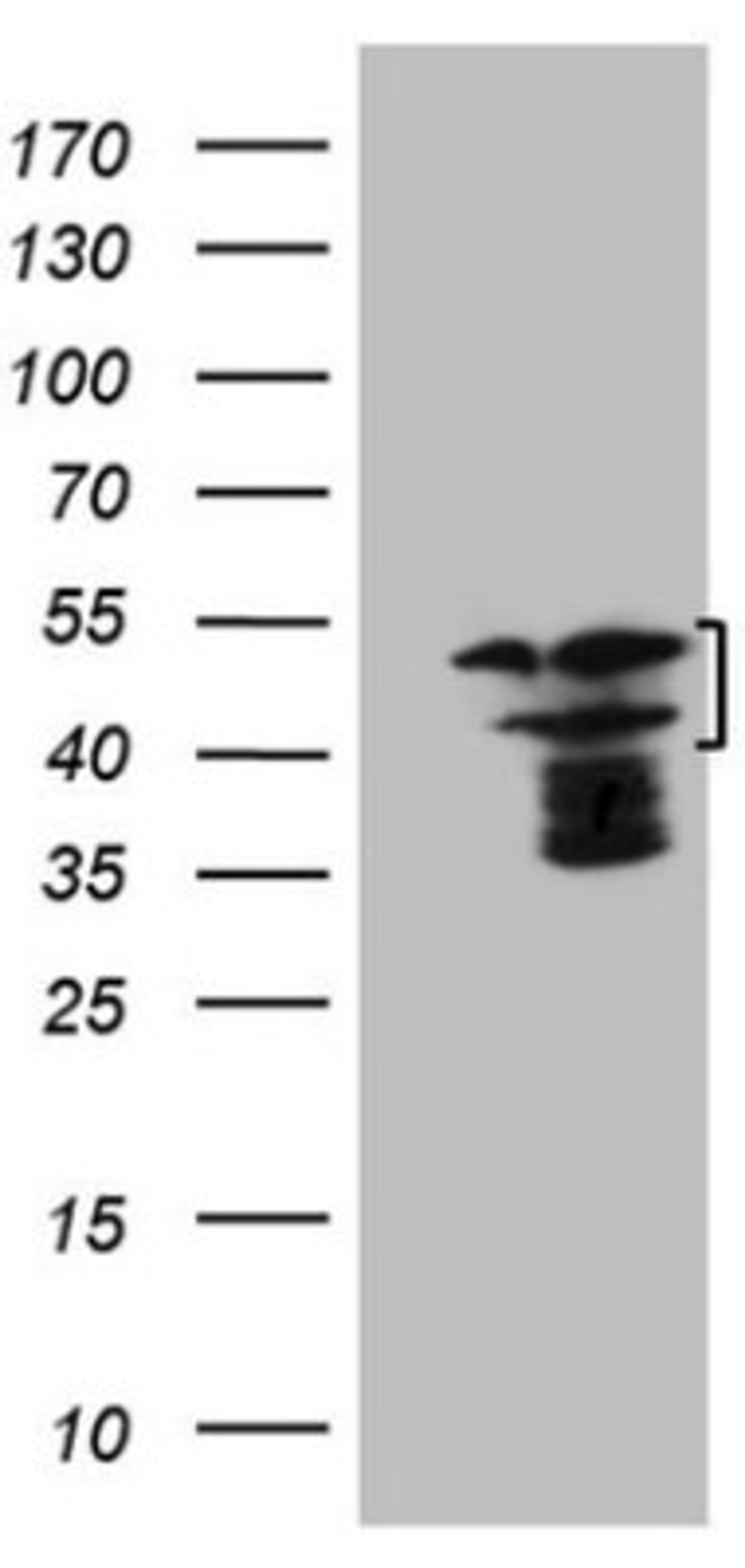 Western Blot: HMG20A Antibody (2H4) [NBP2-45986] - Analysis of HEK293T cells were transfected with the pCMV6-ENTRY control (Left lane) or pCMV6-ENTRY HMG20A .