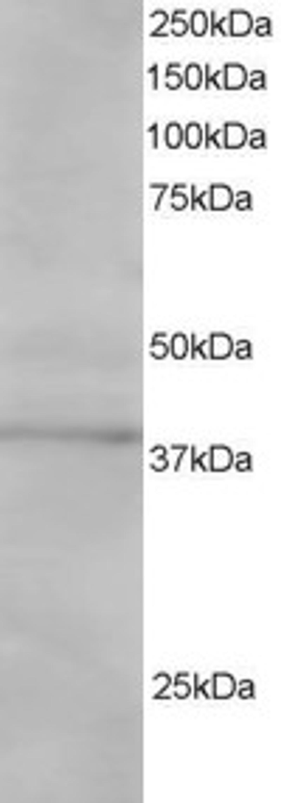 46-328 staining (1ug/ml) of Jurkat lysate (RIPA buffer, 30ug total protein per lane). Primary incubated for 1 hour. Detected by western blot using chemiluminescence.