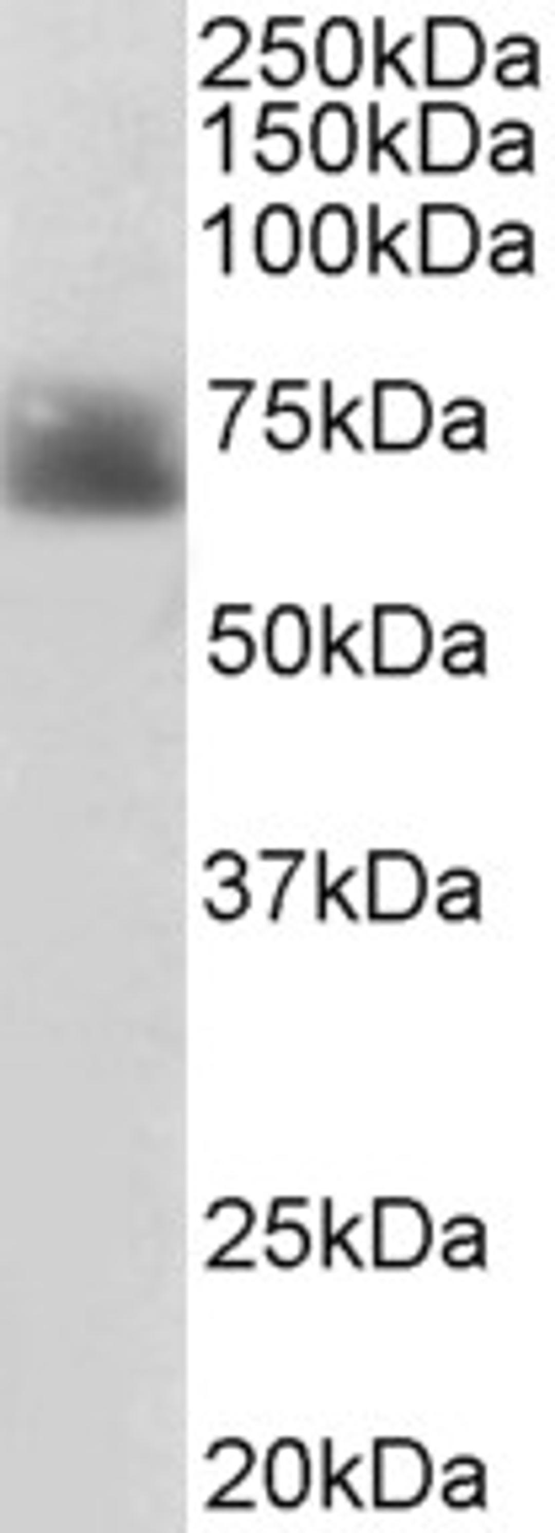 46-377 (2ug/ml) staining of Human Colon lysate (35ug protein in RIPA buffer). Primary incubation was 1 hour. Detected by chemiluminescence.