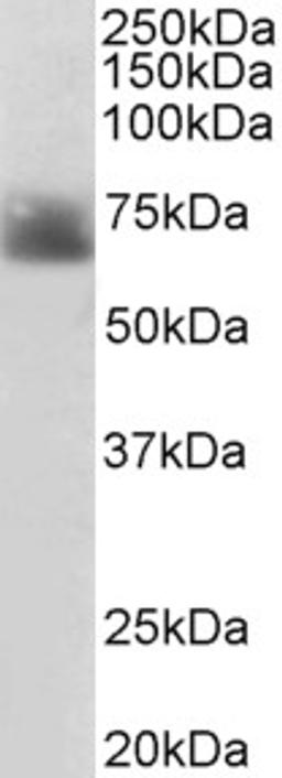 46-377 (2ug/ml) staining of Human Colon lysate (35ug protein in RIPA buffer). Primary incubation was 1 hour. Detected by chemiluminescence.